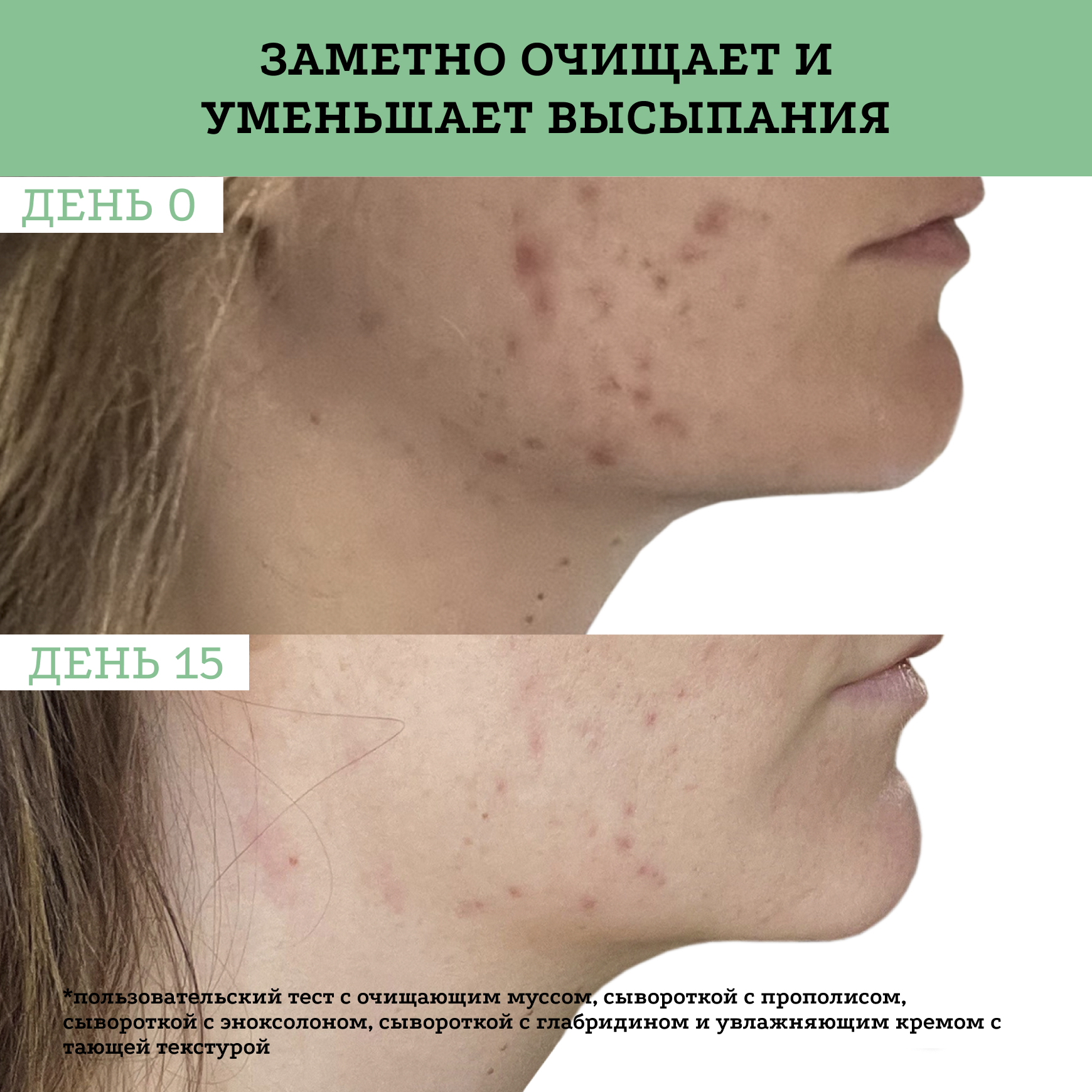 Активные молекулы Сыворотка с прополисом Etat Pur Сокращение несовершенств, сужение пор миниатюра 6