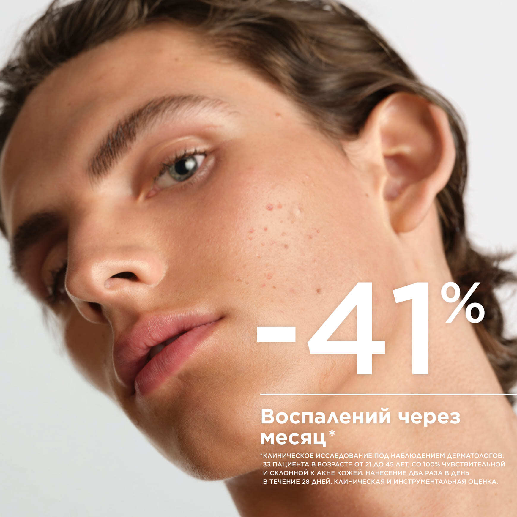 Sébium Сыворотка против несовершенств, постакне и морщин BIODERMA Для кожи, склонной к акне, с первыми признаками старения миниатюра 4