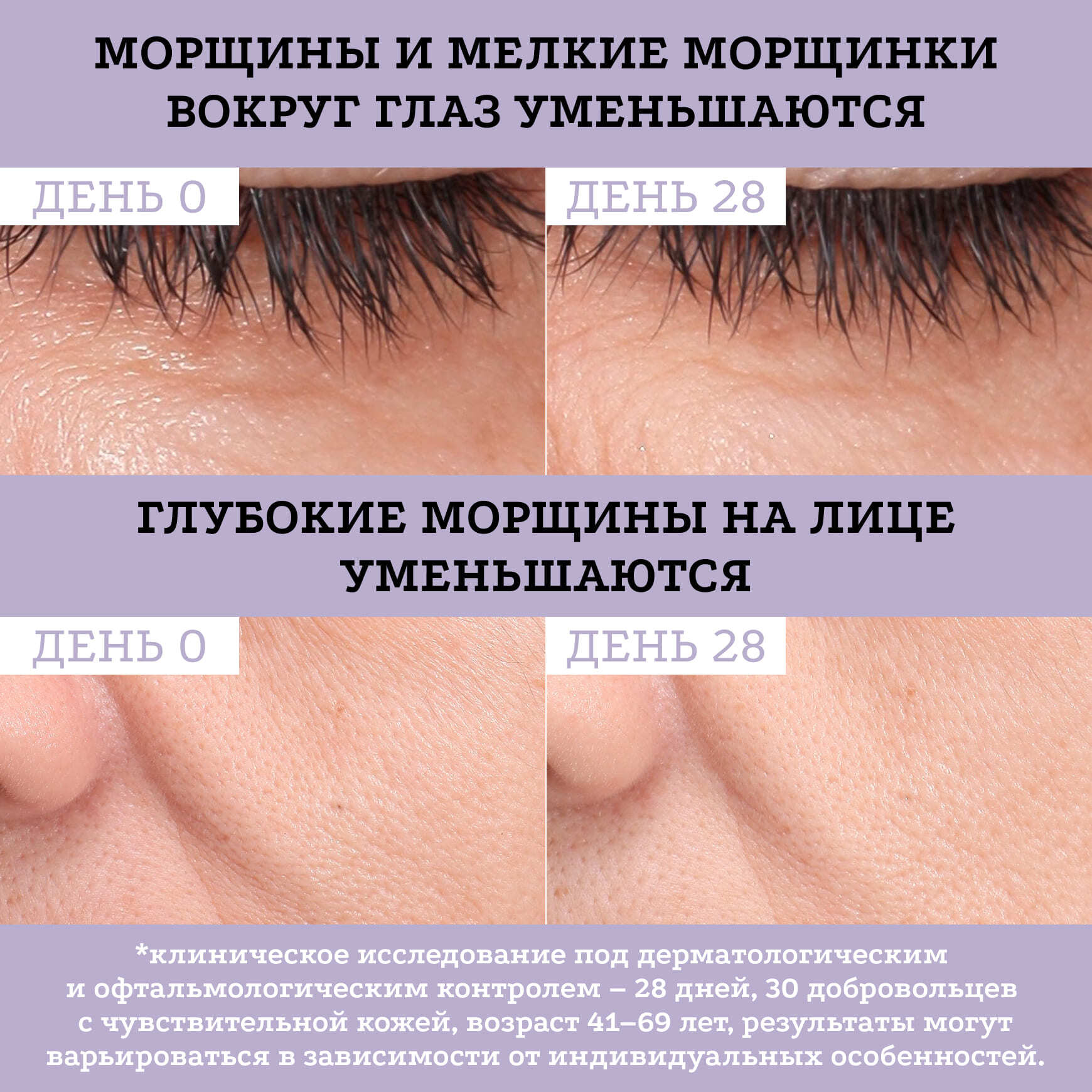 Активные молекулы Сыворотка с бакучиолом 0,5% Etat Pur Разглаживание морщин и улучшение текстуры кожи миниатюра 6