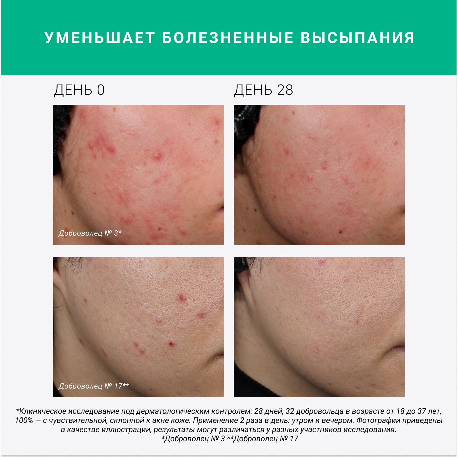 PURE ACTIVES Сыворотка с янтарной кислотой 2% Etat Pur Уменьшает количество несовершенств, подходит для чувствительной кожи миниатюра 11