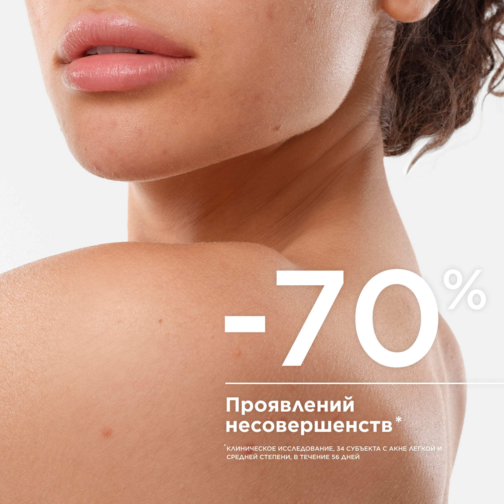 Sébium Kerato+ Cпрей для тела против несовершенств BIODERMA Сокращение несовершенств на теле через 7 дней* миниатюра 3