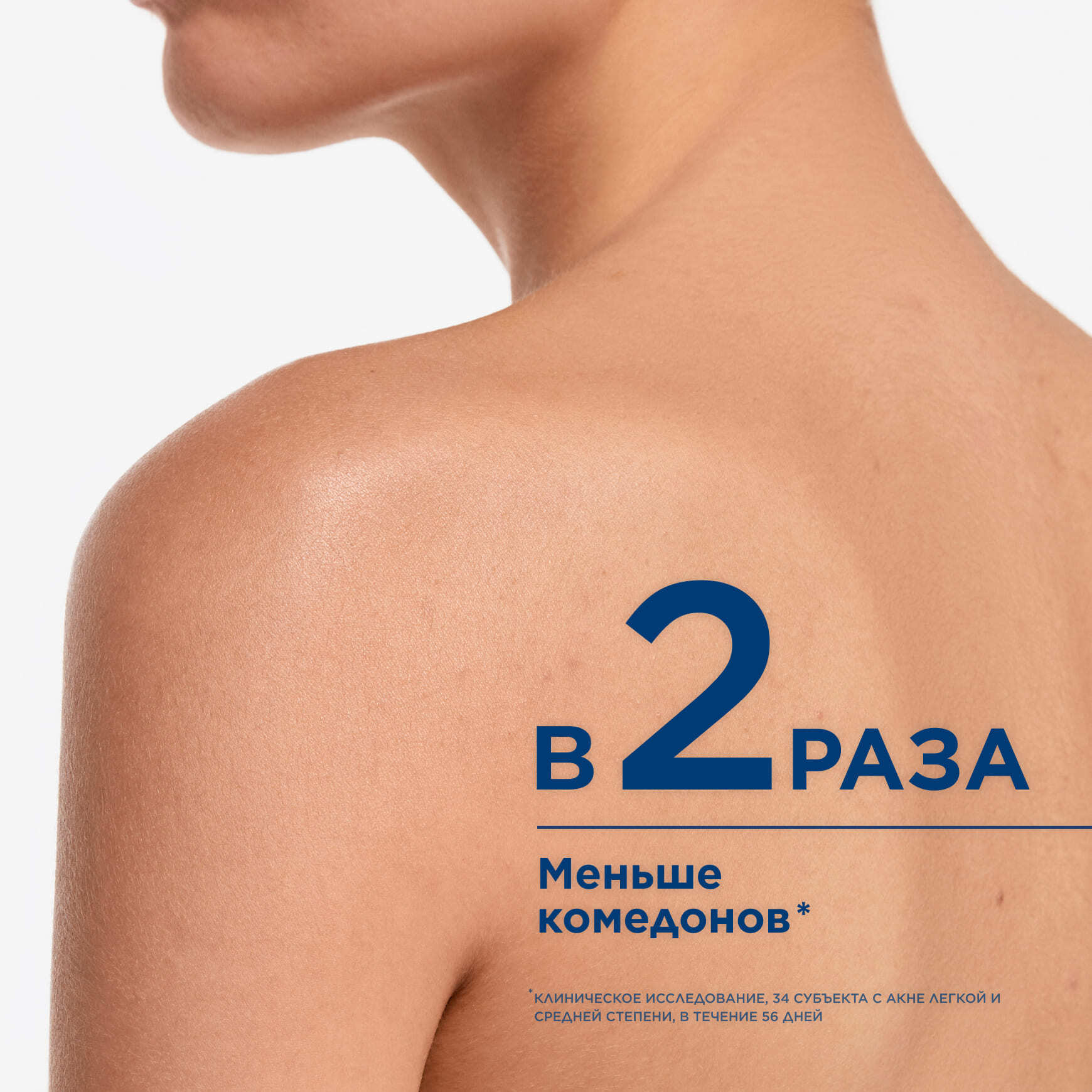Sébium Kerato+ Cпрей для тела против несовершенств BIODERMA Сокращение несовершенств на теле через 7 дней* миниатюра 4