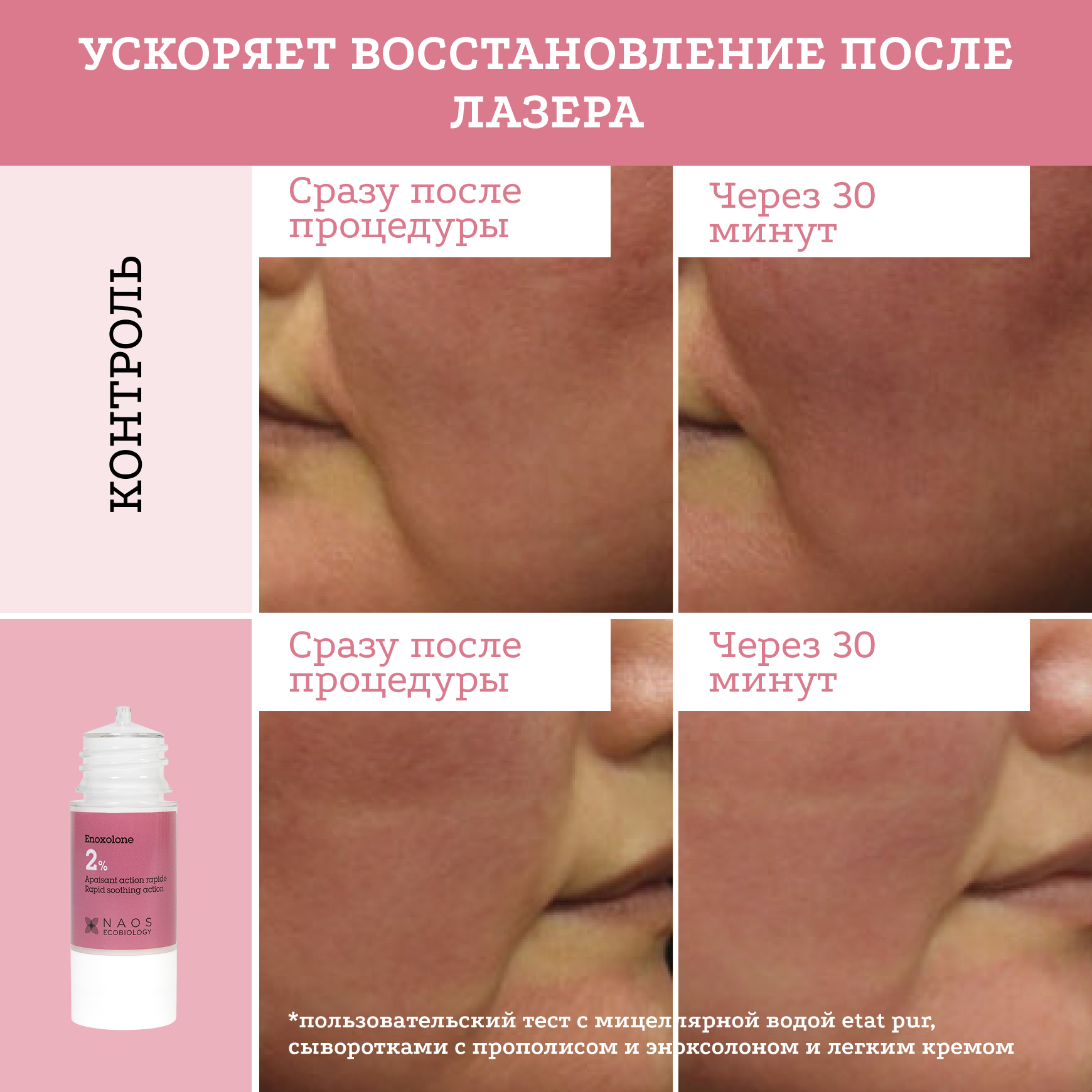 Активные молекулы Сыворотка с эноксолоном 2% Etat Pur Уменьшение ощущения стянутости и чувства дискомфорта миниатюра 6