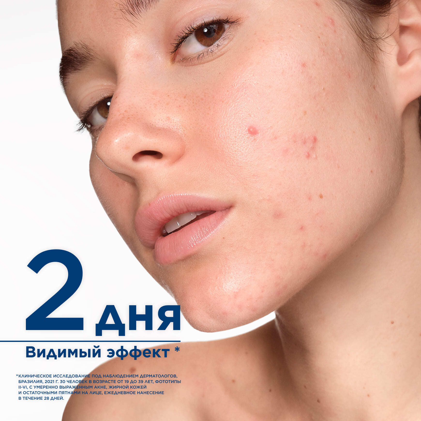 Sébium Гель-крем Керато+ BIODERMA Устраняет несовершенства и черные точки миниатюра 5
