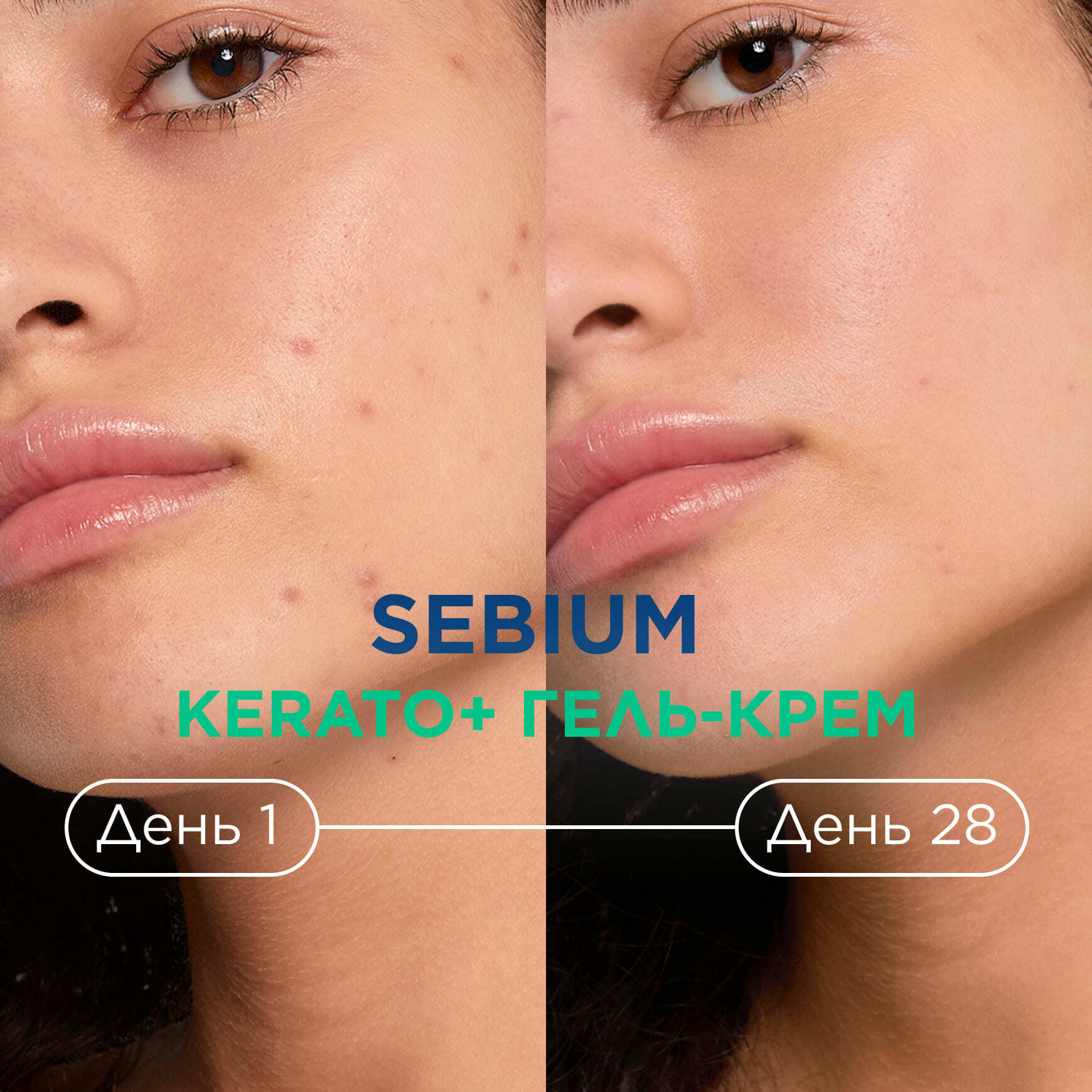 Sébium Гель-крем Керато+ BIODERMA Устраняет несовершенства и черные точки миниатюра 6
